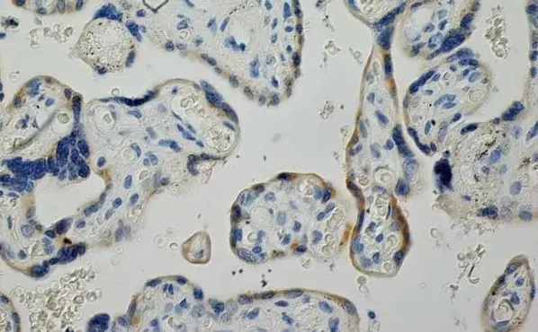 Anti Human Inhibin Alpha Antibody, clone R1 gallery image 10