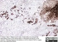 Anti Human Inhibin Alpha Antibody, clone R1 gallery image 11