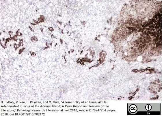 Anti Human Inhibin Alpha Antibody, clone R1 gallery image 11
