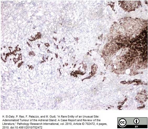 Anti Human Inhibin Alpha Antibody, clone R1 gallery image 11