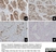 Anti Human Inhibin Alpha Antibody, clone R1 thumbnail image 12