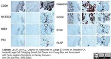 Anti Human Inhibin Alpha Antibody, clone R1 gallery image 13