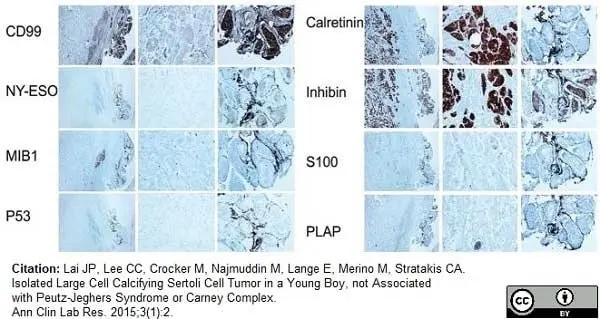 Anti Human Inhibin Alpha Antibody, clone R1 gallery image 13