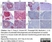 Anti Human Inhibin Alpha Antibody, clone R1 thumbnail image 15