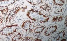 Anti Human Inhibin Alpha Antibody, clone R1 gallery image 2