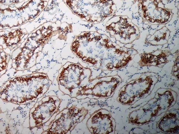 Anti Human Inhibin Alpha Antibody, clone R1 gallery image 2
