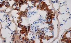 Anti Human Inhibin Alpha Antibody, clone R1 gallery image 3