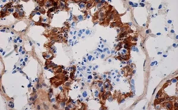 Anti Human Inhibin Alpha Antibody, clone R1 gallery image 3