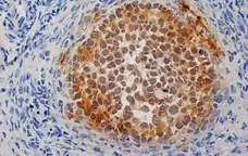Anti Human Inhibin Alpha Antibody, clone R1 gallery image 4