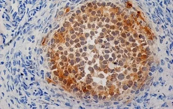 Anti Human Inhibin Alpha Antibody, clone R1 gallery image 4