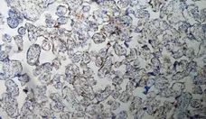 Anti Human Inhibin Alpha Antibody, clone R1 gallery image 5
