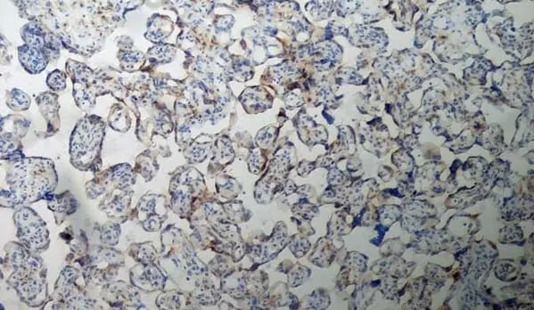 Anti Human Inhibin Alpha Antibody, clone R1 gallery image 5