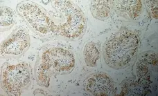 Anti Human Inhibin Alpha Antibody, clone R1 gallery image 6