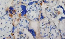 Anti Human Inhibin Alpha Antibody, clone R1 gallery image 7