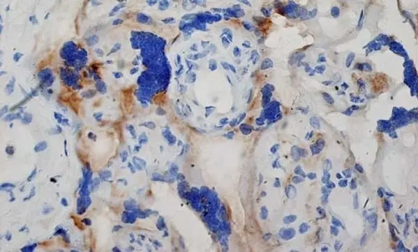 Anti Human Inhibin Alpha Antibody, clone R1 gallery image 7