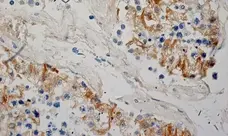 Anti Human Inhibin Alpha Antibody, clone R1 gallery image 8