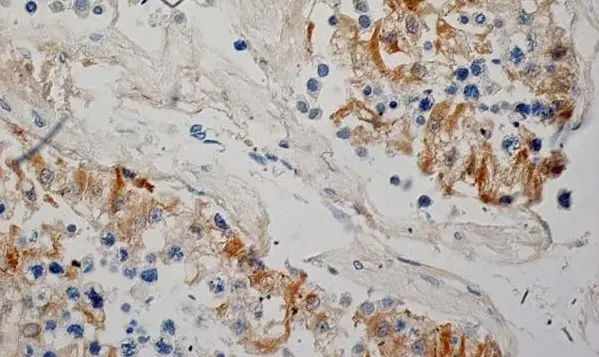 Anti Human Inhibin Alpha Antibody, clone R1 gallery image 8