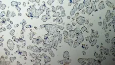 Anti Human Inhibin Alpha Antibody, clone R1 gallery image 9