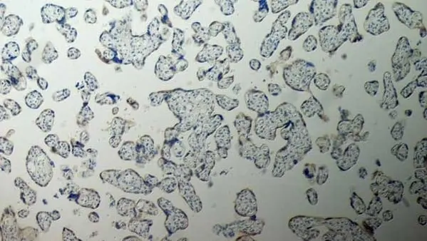 Anti Human Inhibin Alpha Antibody, clone R1 gallery image 9