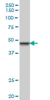 Anti Human INI-1 Antibody, clone 3E10 gallery image 1