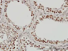 Anti Human INI-1 Antibody, clone 3E10 gallery image 2