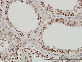 Anti Human INI-1 Antibody, clone 3E10 gallery image 2