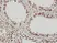 Anti Human INI-1 Antibody, clone 3E10 thumbnail image 2