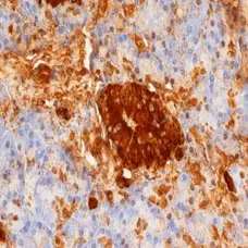 Anti Human Insulin/Proinsulin Antibody, clone D3E7 (5B6/6) gallery image 1