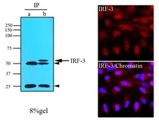 Anti Human IRF3 Antibody, clone 3F10 gallery image 2