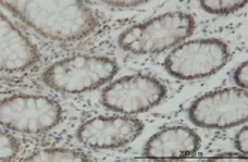 Anti Human JARID1B Antibody, clone 1G10 gallery image 1