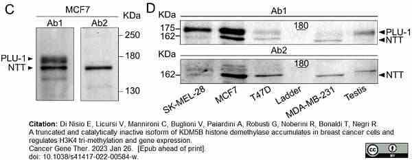 Anti Human JARID1B Antibody, clone 1G10 gallery image 3