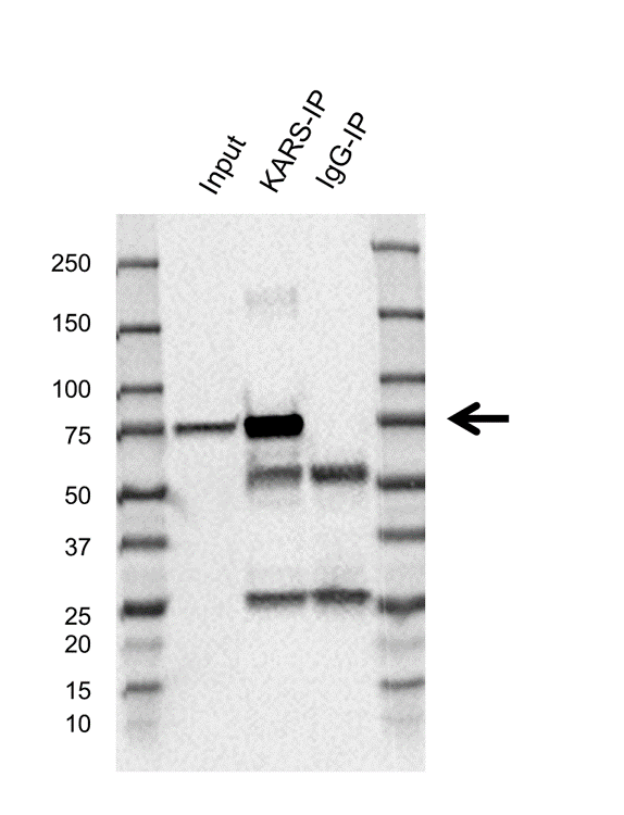 Anti Kars Antibody, clone AB01/3F8 (PrecisionAb Monoclonal Antibody) gallery image 2