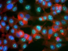 Anti Ki67 Antibody, clone AbD02531 gallery image 1