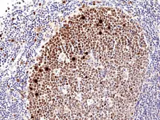 Anti Ki67 Antibody, clone RM360 gallery image 1