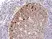 Anti Ki67 Antibody, clone RM360 thumbnail image 1