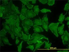 Anti Human KRAS Antibody, clone 3B10-2F2 gallery image 1