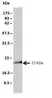 Anti Human KRAS Antibody, clone 3B10-2F2 thumbnail image 2