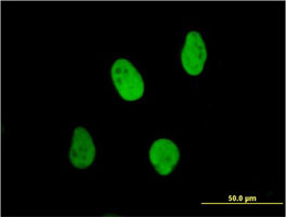 Anti Human Ku70 Antibody, clone 4C2-1A6 thumbnail image 2