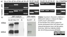 Anti Human Laminin Alpha 5 Antibody, clone 4C7 (2D8/33) gallery image 1