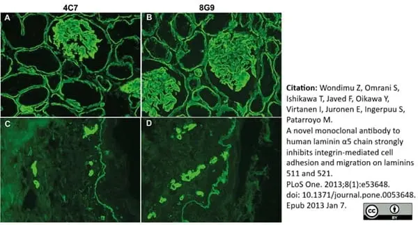 Anti Human Laminin Alpha 5 Antibody, clone 4C7 (2D8/33) gallery image 3