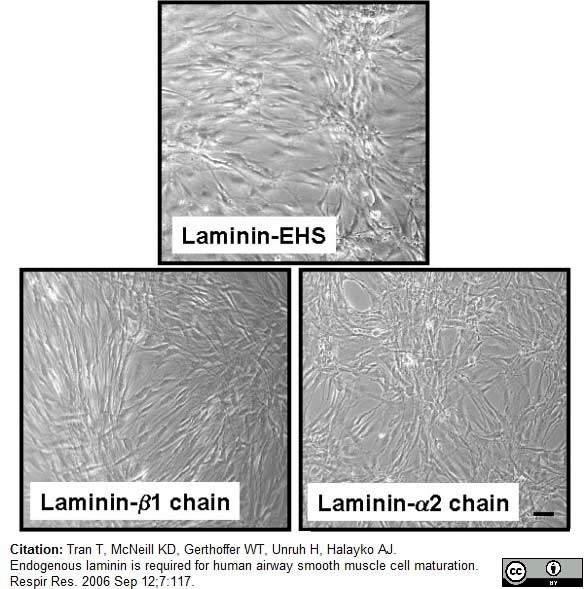 Anti Human Laminin Alpha 2 Antibody, clone 5H2 thumbnail image 1