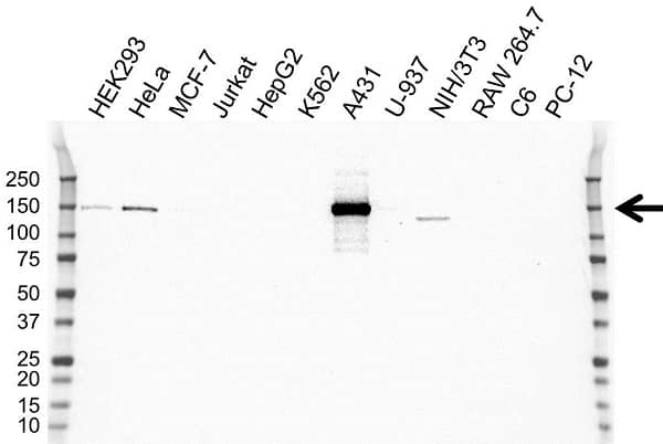 Anti Laminin Beta 3 Antibody, clone OTI3A2 (PrecisionAb Monoclonal Antibody) gallery image 1