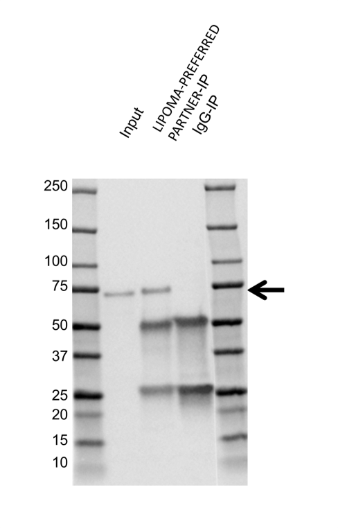 Anti Lipoma-Preferred Partner Antibody, clone 8B3A11 (PrecisionAb Monoclonal Antibody) gallery image 3