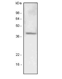 Anti Human LYVE-1 Antibody, clone 4G1 gallery image 1