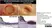 Anti Human Macrophages Antibody, clone MAC387 thumbnail image 10