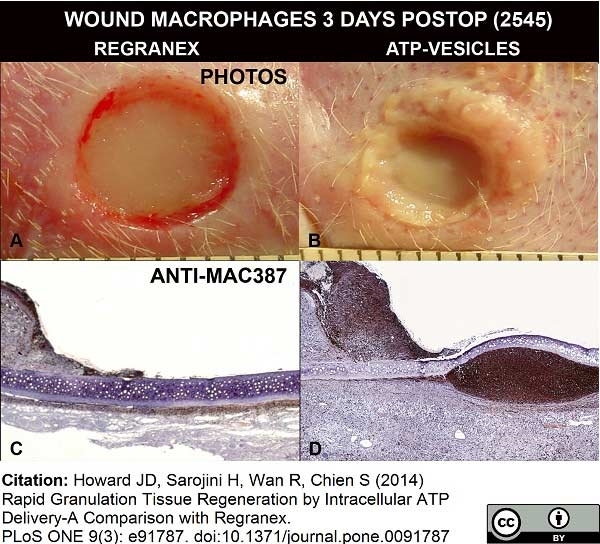 Anti Human Macrophages Antibody, clone MAC387 gallery image 10