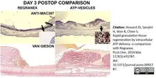 Anti Human Macrophages Antibody, clone MAC387 gallery image 11