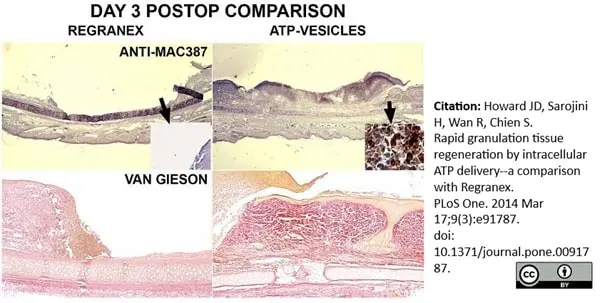 Anti Human Macrophages Antibody, clone MAC387 gallery image 11