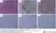 Anti Human Macrophages Antibody, clone MAC387 thumbnail image 12