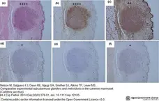 Anti Human Macrophages Antibody, clone MAC387 gallery image 13